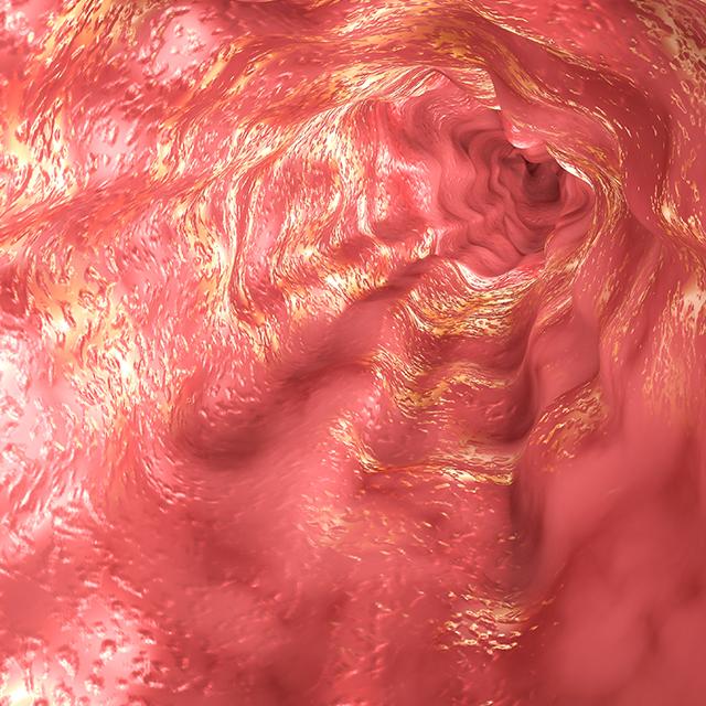Image of Esophagus mucosa and esophageal sphincter